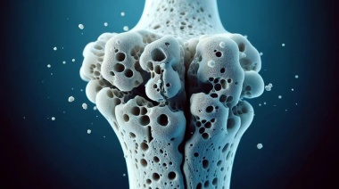Cuál es la vitamina que ayuda a prevenir la osteoporosis y qué alimentos la contienen